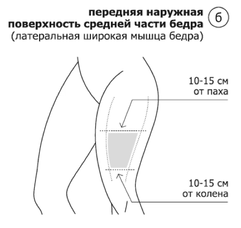 Иллюстрация передняя наружная поверхность средней части бедра